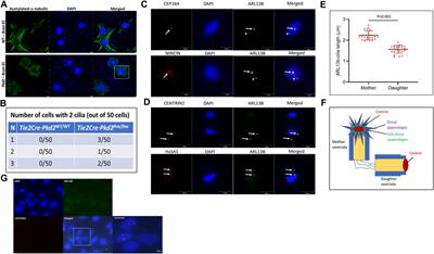 Brain microvascular endothelial cells possess a second cilium that arises from the daughter centriole